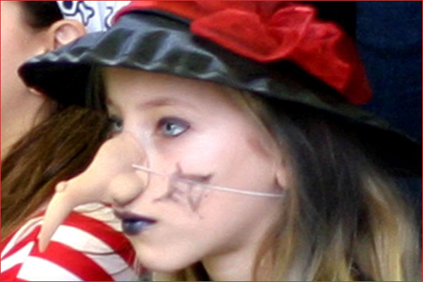Nase